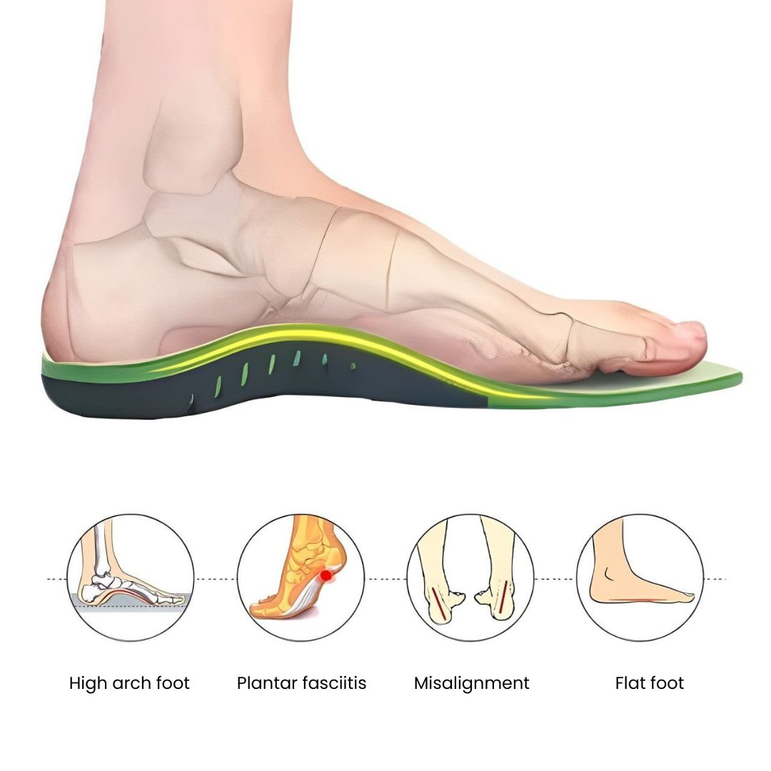 Orthopedic Insoles for Plantar Pain