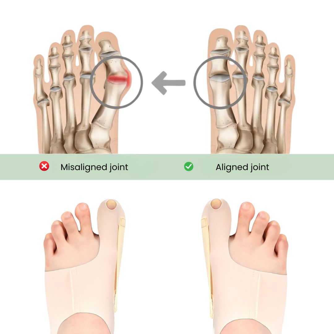 Invisible Bunion Relief Socks