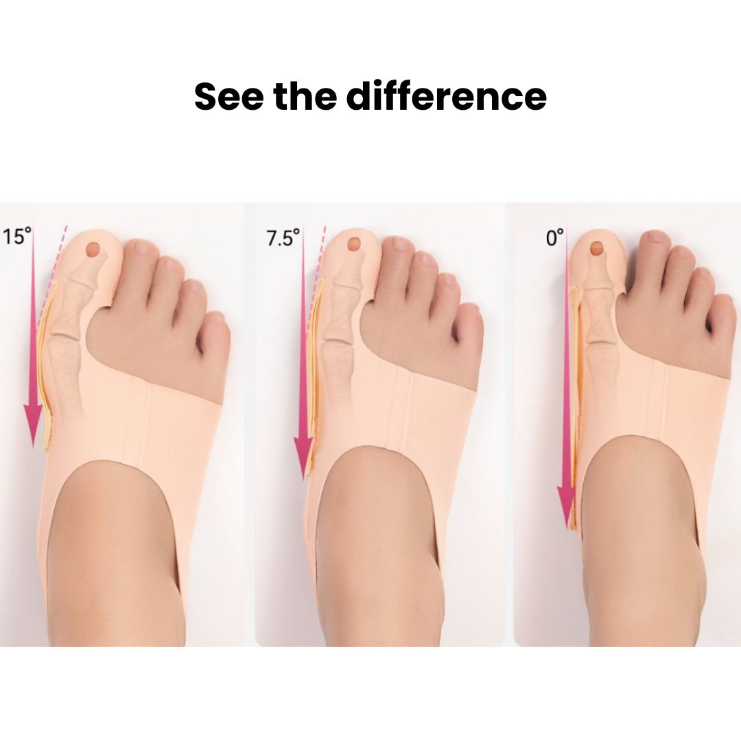 Invisible Bunion Relief Socks