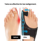 Night Splint for Hallux Valgus (One size fit all)