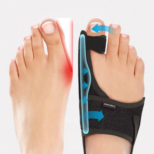 Night Splint for Hallux Valgus (One size fit all)