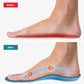Orthopedic Insoles for Bunions