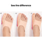 Invisible Bunion Relief Socks