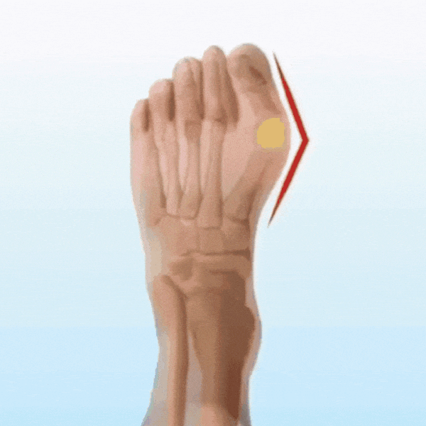 Daytime Bunion Sleeve (One Size Fits All)
