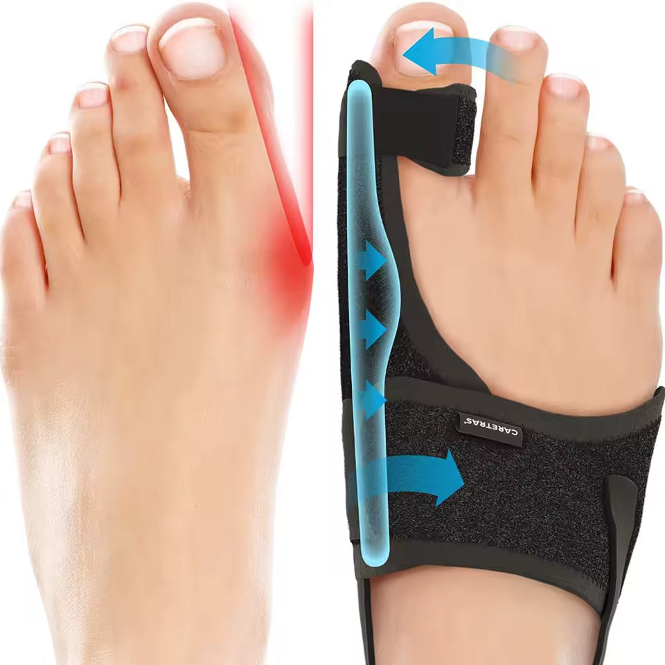 Night Splint for Hallux Valgus (One size fit all)